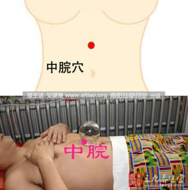 中脘穴位于腹部正中線，臍上4寸的位置上。每天艾灸10-15分鐘，能有效緩解胃部不適的癥狀，同時(shí)有助于祛濕。